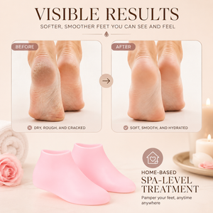 Before and after using ZERVANI Hydrating Silicone Socks — softer, smoother feet